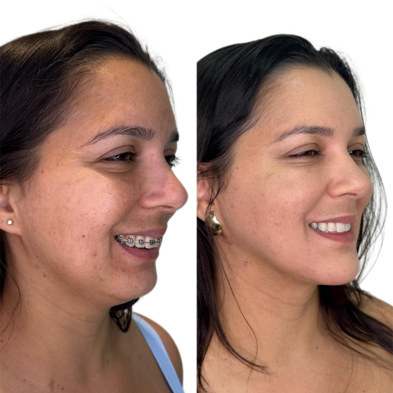 Descrição do caso 1